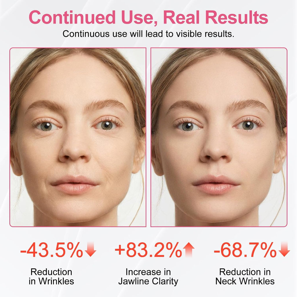 Red Light Beauty Device for Face and Neck, Based on High-end Red and Blue LED Light, Facial Cold and Hot, Vibration Technology, 3 Color Led Face and Neck Beauty Device for Home Use, Light Pink (Pink)