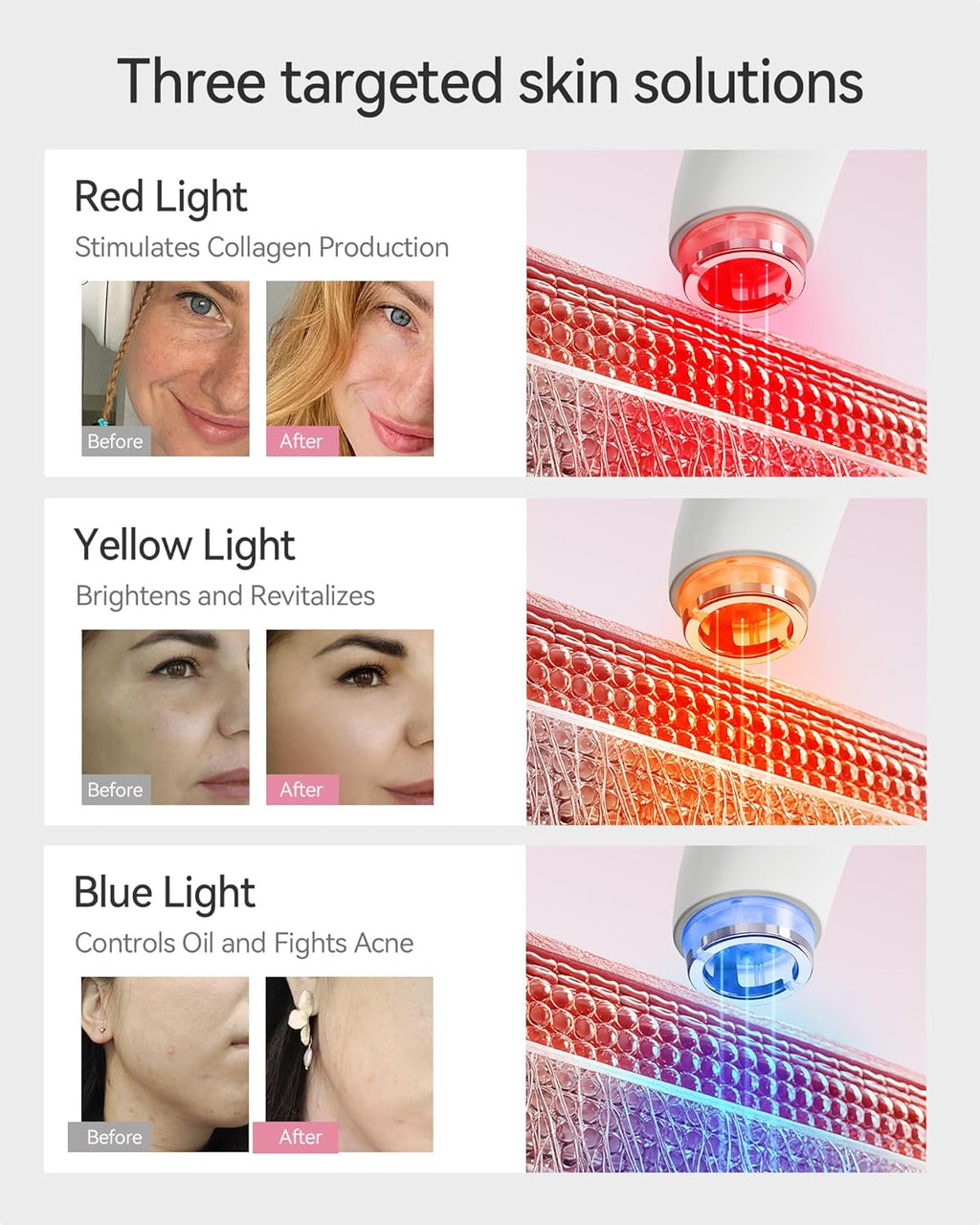 FliKEZE Red Light Therapy Device for Face and Neck, 3-in-1 Microcurrent & Vacuum Facial Massager, Skin Tightening, Firming and Anti-Aging Skincare Tool (White)
