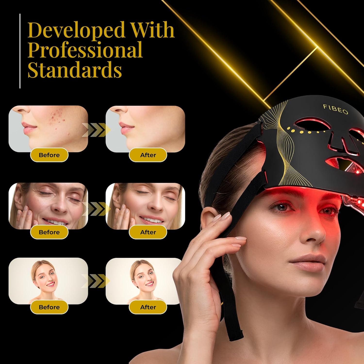 LED Red Light Therapy Mask for Face, FDA-Cleared 630nm Red, 850nm Near-Infrared & 415nm Blue Light, 324 LED Chips, 3 Modes, 5 Intensity Levels, Remote Controller – At-Home Skin Care Device